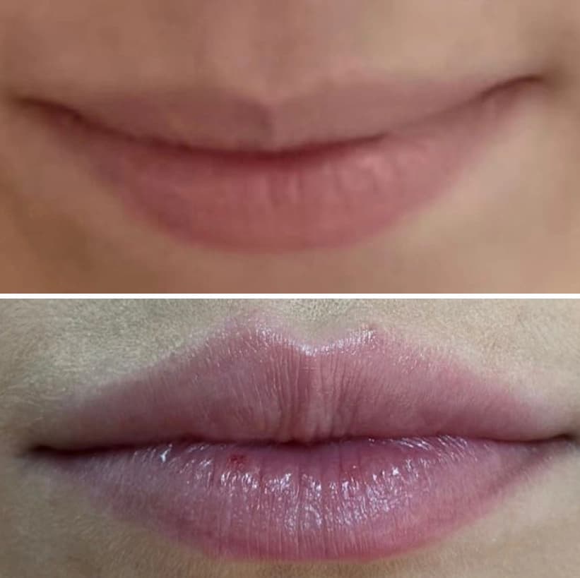 Depois — Resultado real